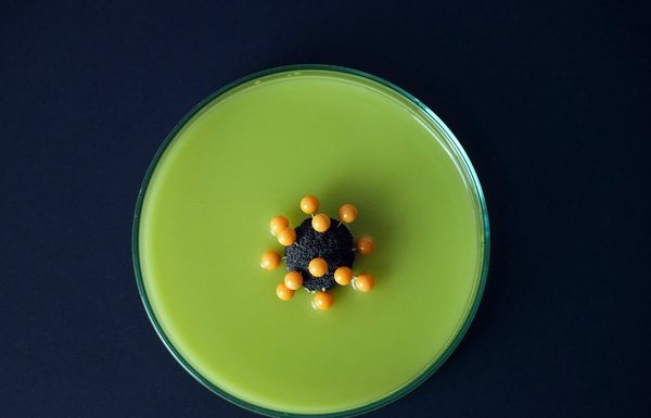 Los activistas de acceso critican el vacilante esfuerzo de la OMS para compartir la propiedad intelectual de los medicamentos contra el coronavirus